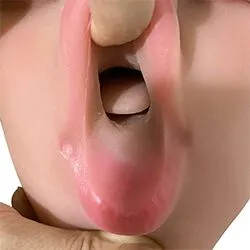 Fixed Tongue(Free)